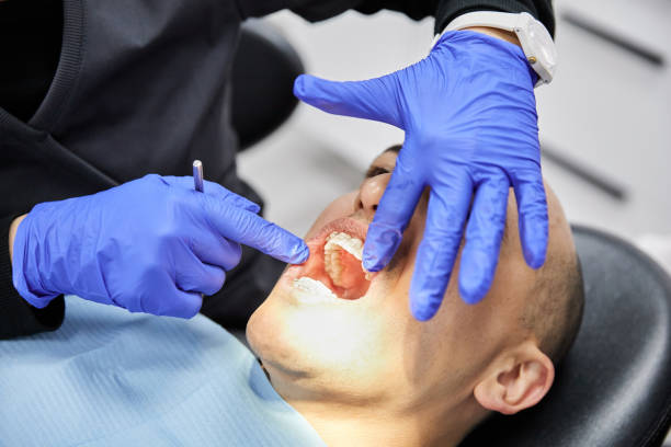 Best Knocked-Out Tooth (Avulsed Tooth) Treatment in Pleasant Valley, MO