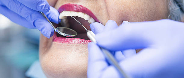 Best Knocked-Out Tooth (Avulsed Tooth) Treatment in Pleasant Valley, MO